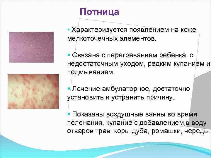 Кожные проявления целиакии: что нужно знать