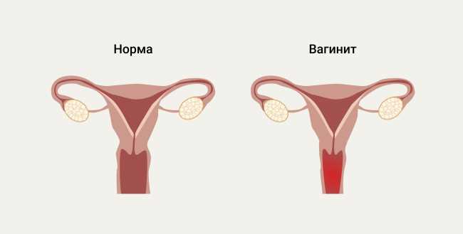 Научные исследования о сперме и влагалище