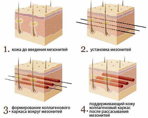 Сравнение мезонитей с другими методами подтяжки кожи