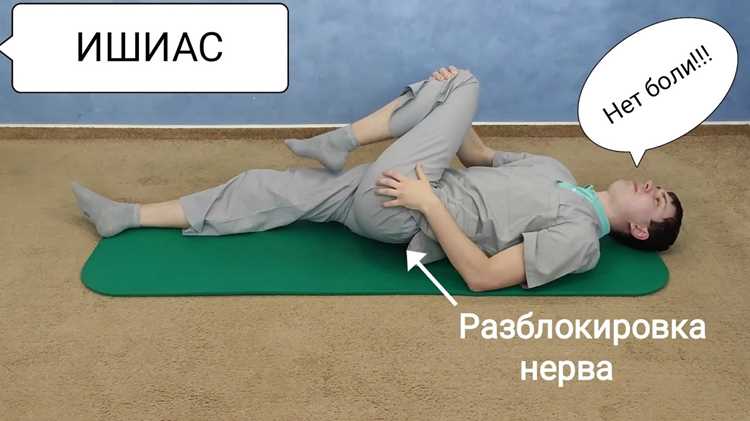 Понимание анатомии седалищного нерва