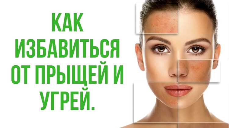 Способы уменьшения воспаления: медикаменты и домашние средства