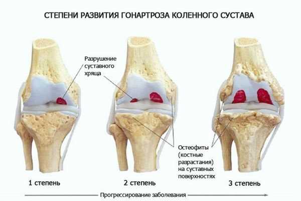 Роль рентгенографии в диагностике травм сустава