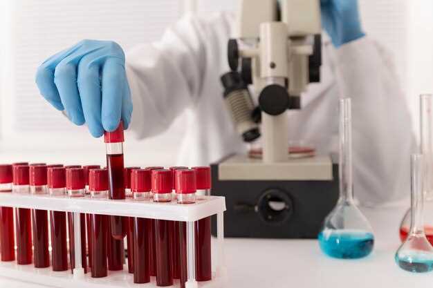 Связь уровня лимфоцитов с симптомами и клинической картиной