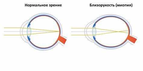Разновидности