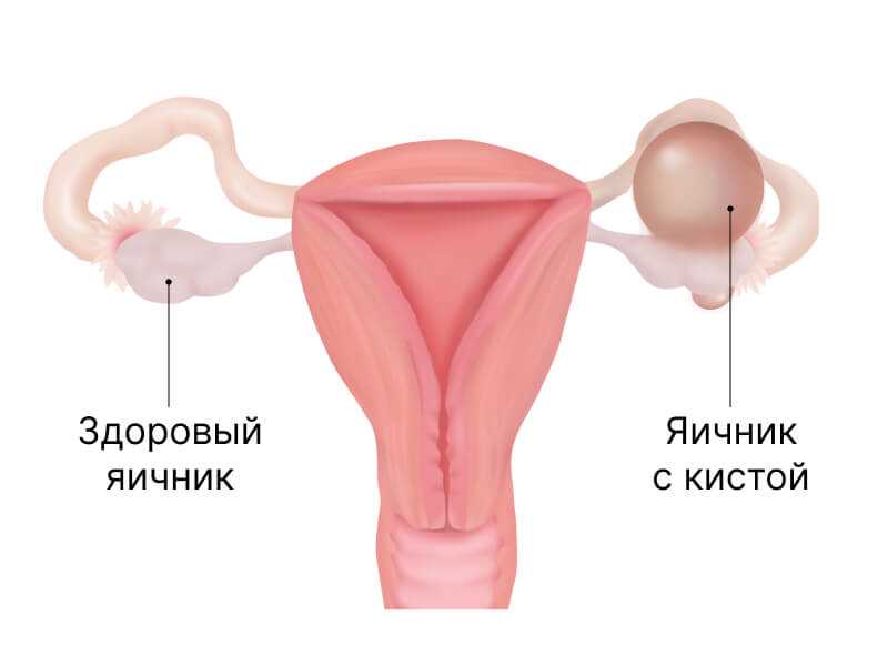 3.
