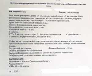 Подготовка