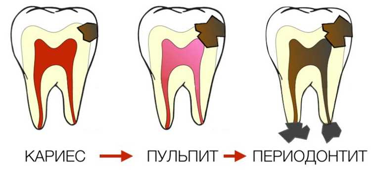 Методы диагностики разрушительных изменений зубов