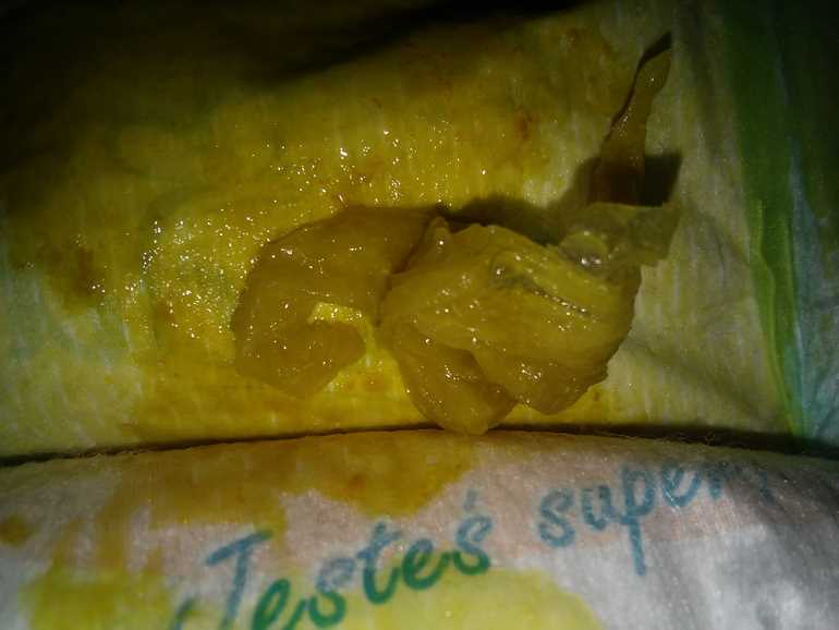 1.