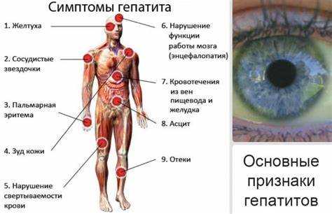 Признаки поражения печени при алкогольном токсическом гепатите