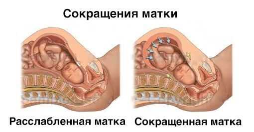 Советы