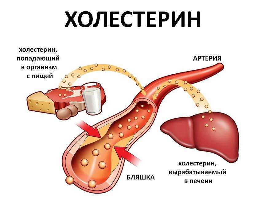 Диета