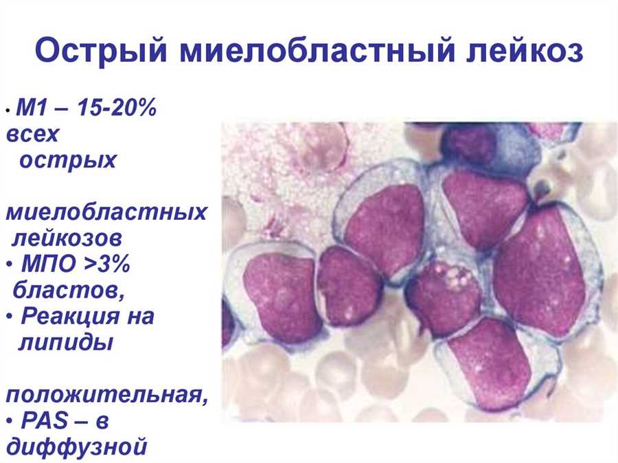 Причины