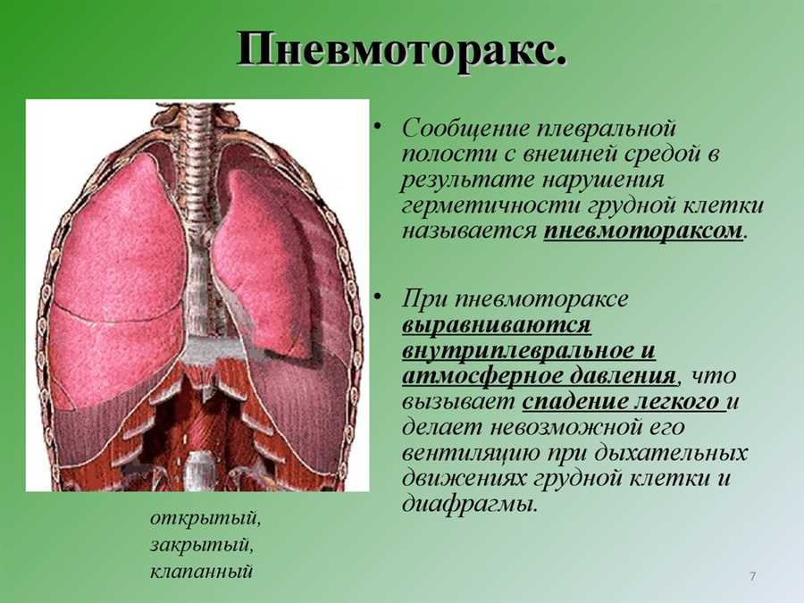 Симптомы