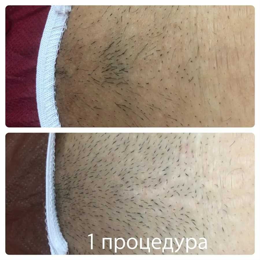 Техники
