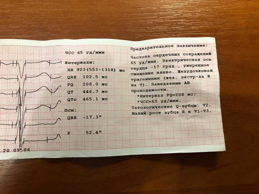 Что