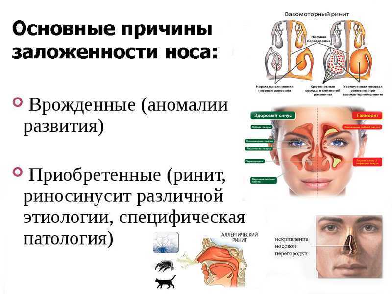 Упражнения